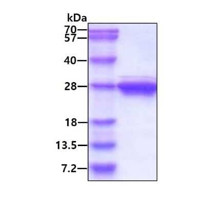 SDS-PAGE Recombinant Human Cytoglobin His Protein